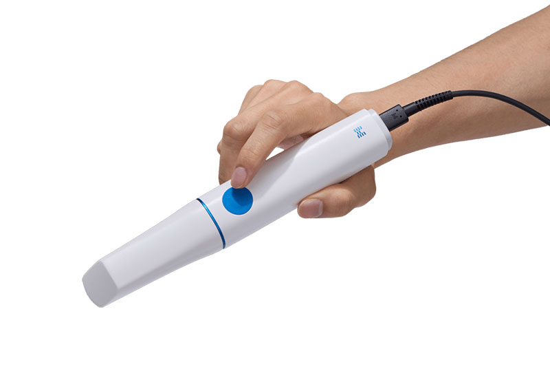 Intra-Oral Scanner in Las Vegas