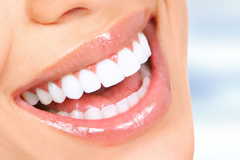 Henderson Smiles Special Offer