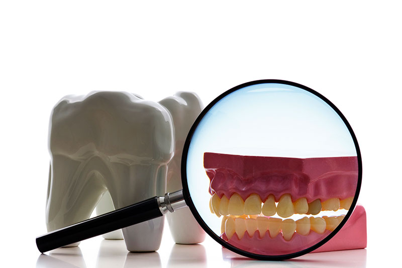 Root Canal in Green Valley, Henderson, Las Vegas