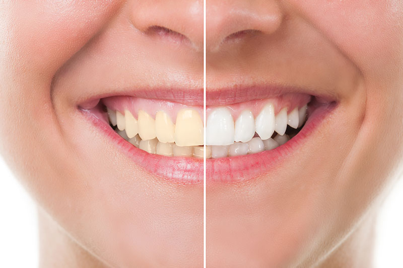 Dental Treatments in Las Vegas