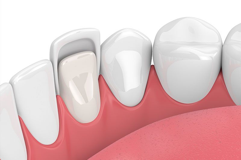 Dentist in Las Vegas